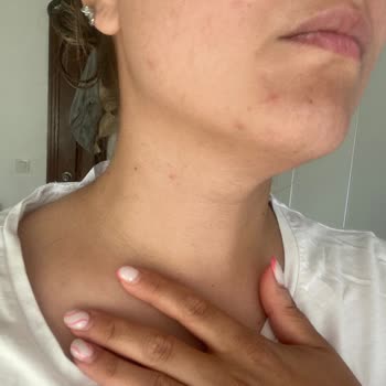 Yves Roche Güneş Kremi