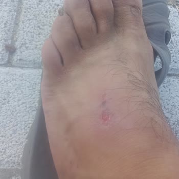 İBB - İstanbul Büyükşehir Belediyesi Şantiye Koşullarının Sağlığımıza Olumsuz Etkileri