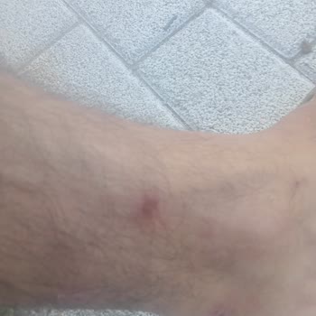 İBB - İstanbul Büyükşehir Belediyesi Şantiye Koşullarının Sağlığımıza Olumsuz Etkileri