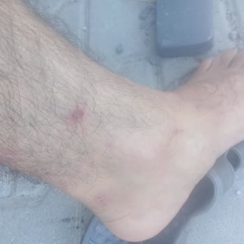 İBB - İstanbul Büyükşehir Belediyesi Şantiye Koşullarının Sağlığımıza Olumsuz Etkileri