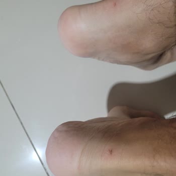 SuperStep Adidas Samba Ayağa Vurma Problemi