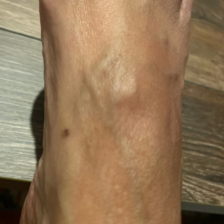 Desa Deri İade Reddi