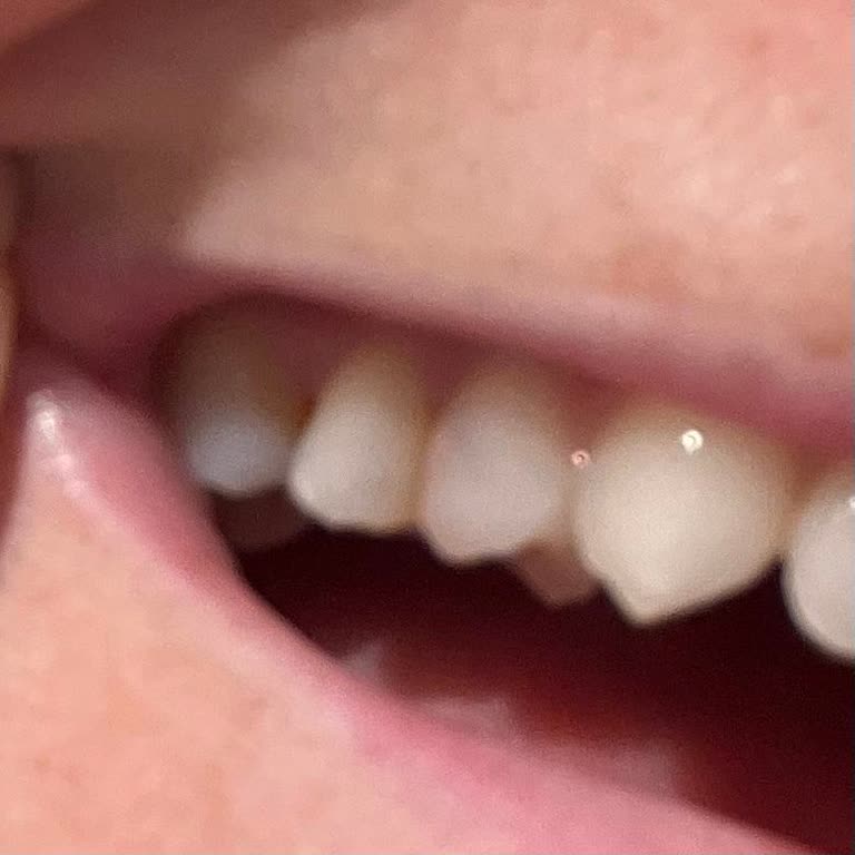 İnegöl Ağız ve Diş Sağlığı Hastanesi Diş Doktorunun Hastaya Yardımcı Olmaması