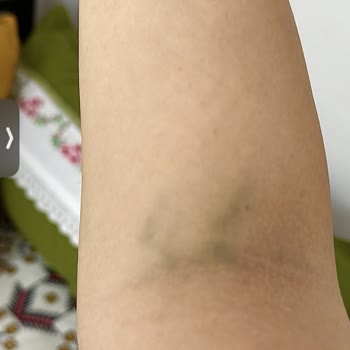 Doruk Nilüfer Hastanesi Acil Hemşirelerinin Tecrübesizliği