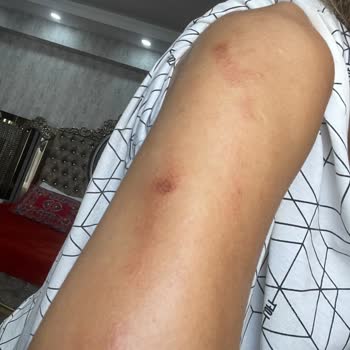 Dr. Eylem Kılınç Güzellik Merkezi Merdiven Hizmet