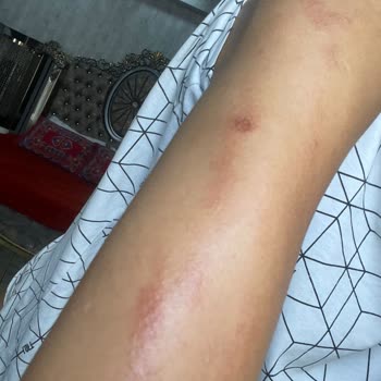 Dr. Eylem Kılınç Güzellik Merkezi Merdiven Hizmet