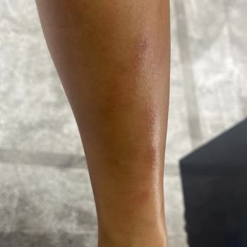 Dr. Eylem Kılınç Güzellik Merkezi Merdiven Hizmet