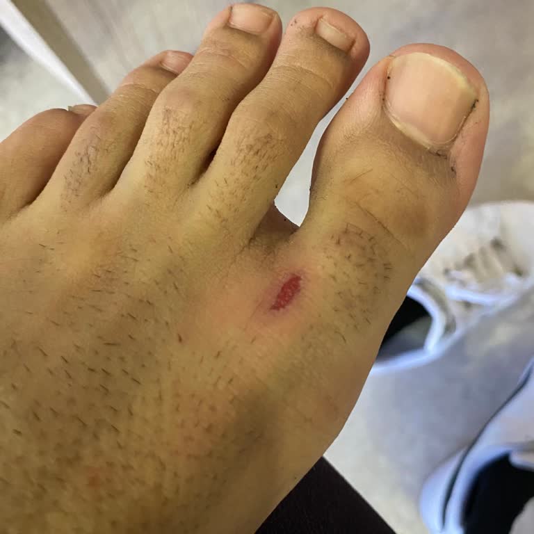 FLO'dan Aldığım Puma Ayakkabının Hatalı Olması