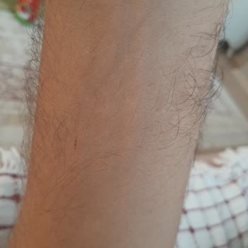 Ajet Kırık Koltuktan Düşürdü.