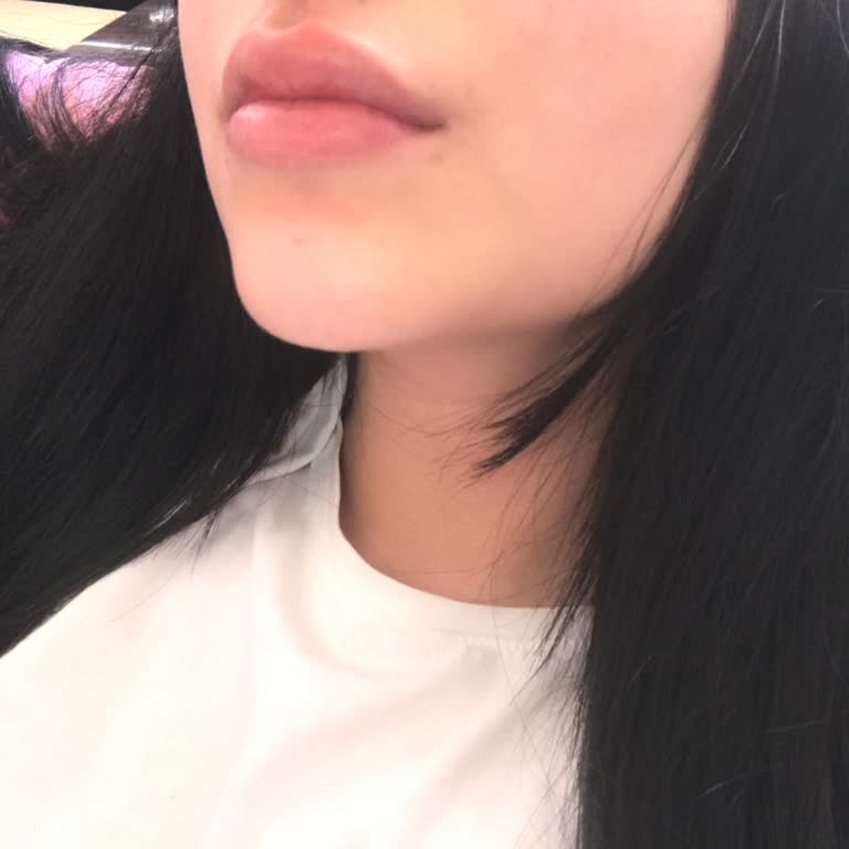 Negative Reaction to Parodontax Sensitive Toothpaste - Severe Mouth Irritation and Swelling