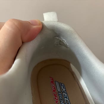 Skechers Markasının Kalite Sorununu Kabul Etmemesi