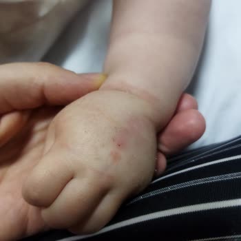 Gaziantep Bossan Hastanesi Hemşirelerinin Deneyimsizliği