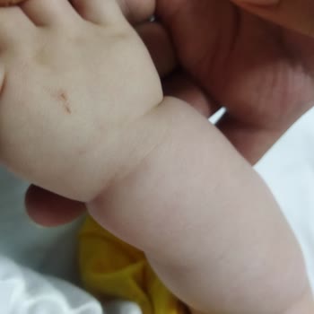 Gaziantep Bossan Hastanesi Hemşirelerinin Deneyimsizliği