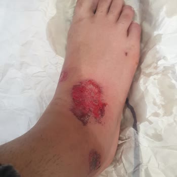 Yeni Hayat Tıp Merkezi Kaza Sonrası Uygunsuz Yaklaşım Ve Rapor Talebinin Reddi