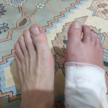 Yeni Hayat Tıp Merkezi Kaza Sonrası Uygunsuz Yaklaşım Ve Rapor Talebinin Reddi