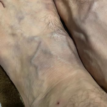 Elle Ayakkabı Elle Markasından Aldığım Terlikte Boya Sorunu