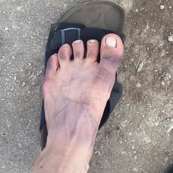 Elle Ayakkabı Elle Markasından Aldığım Terlikte Boya Sorunu