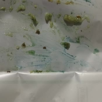 A101 Market Ürünü Sağlık Sorunlarına Yol Açtı