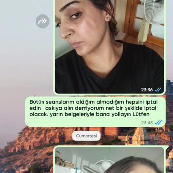 Queenzz Estetik ve Güzellik Merkezi Lazer Sonucu Yanık