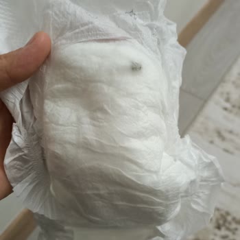 Sleepy Bebek Bezindeki Ne Olduğu Belli Olmayan Madde