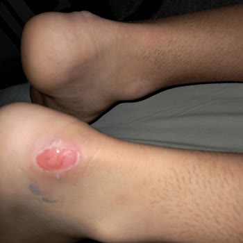 Adidas Krampon Pişmanlıktır! Sattığın Ürünün Arkasında Dur.