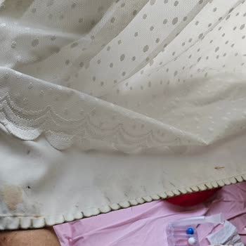 Mehmet Akif Ersoy Göğüs Kalp ve Damar Cerrahisi Eğitim ve Araştırma Hastanesi Hastane Koridorlarında Zorlu Bekleyiş