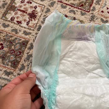 Cırtları Eksik Jenny & Willy Bebek Bezi Mağduriyeti