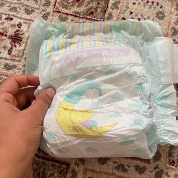 Cırtları Eksik Jenny & Willy Bebek Bezi Mağduriyeti