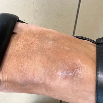 Derimod Deforme Ve Hatalı Ürününün Arkasında Durmuyor.