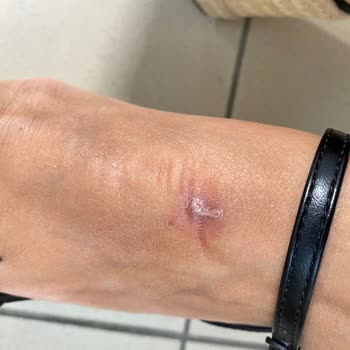 Derimod Deforme Ve Hatalı Ürününün Arkasında Durmuyor.