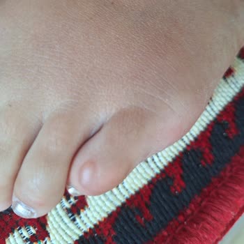 Polaris Kadın Sandalet Ayağa Vuruyor