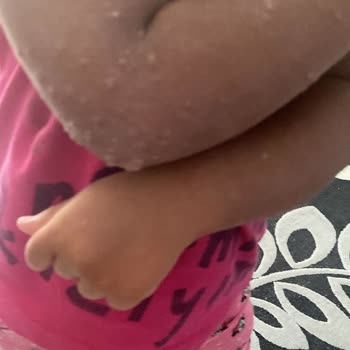 Aydınbey Hotels Otelde Hijyen Sıkıntısı