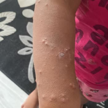 Aydınbey Hotels Otelde Hijyen Sıkıntısı