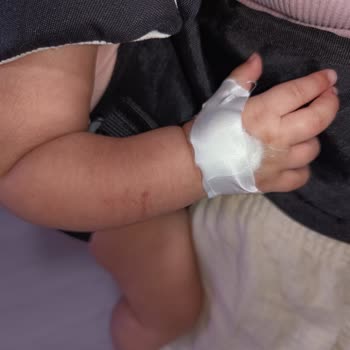 Egemed Hastanesi Hemşireleri Bebekten Kan Almayı Bilmiyor