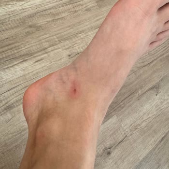 Bambi Ayakkabı Korupark Saygısız Yetkili Kalitesiz Ürün