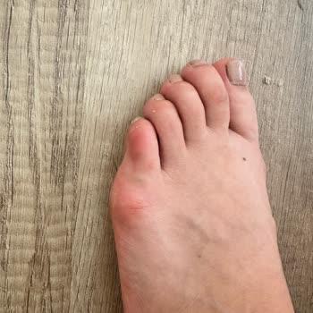 Bambi Ayakkabı Korupark Saygısız Yetkili Kalitesiz Ürün