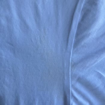 Rexona Alerji Yaptı Ve Kıyafetlerde Lekeler Oluştu