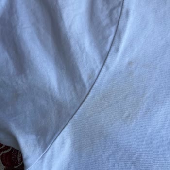 Rexona Alerji Yaptı Ve Kıyafetlerde Lekeler Oluştu