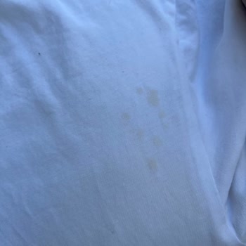 Rexona Alerji Yaptı Ve Kıyafetlerde Lekeler Oluştu