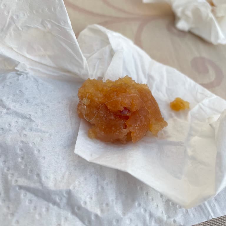 Noxinn Deluxe Hotel Otelde Hijyen Ve Gıda Güvenliği Sorunları