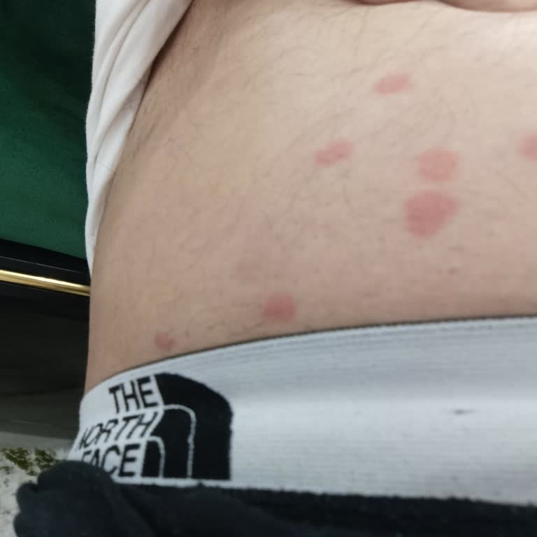 Abdi İbrahim Lifta Alerji Yaptı