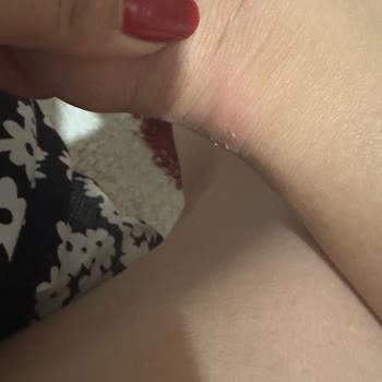 Stradivarius Ayakkabı Ayağımı Yara Yaptı