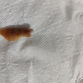 Miskos Helva Miskos Marka Dondurma Külahından Tırnak Ya Da Kemik Çıktı