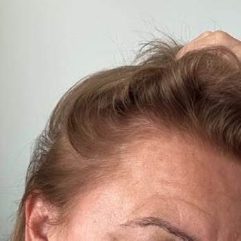 H&S Hair Studio (İzmir) İşini Yapamayan Kuaför!