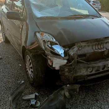 Axa Sigorta İlgisizliği Ve RS Servis Arasında Sıkışmak.