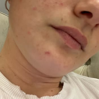 Yves Rocher İndirimdeki Ürünlerin İçeriği, Cildimi Tamamen Bozdu!