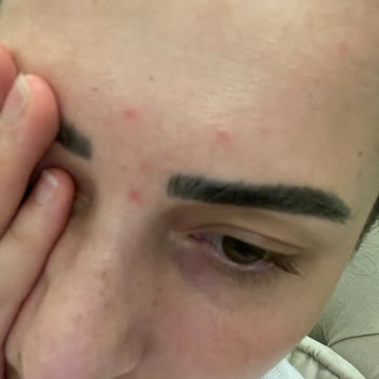 Yves Rocher İndirimdeki Ürünlerin İçeriği, Cildimi Tamamen Bozdu!