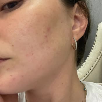 Yves Rocher İndirimdeki Ürünlerin İçeriği, Cildimi Tamamen Bozdu!