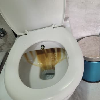 Etstur Kusadasi Palmira Beach Hotel Her Şey Sorunlu