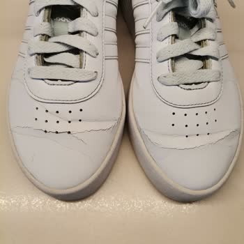 Adidas Bayan Ayakkabı Deri Çatlaması